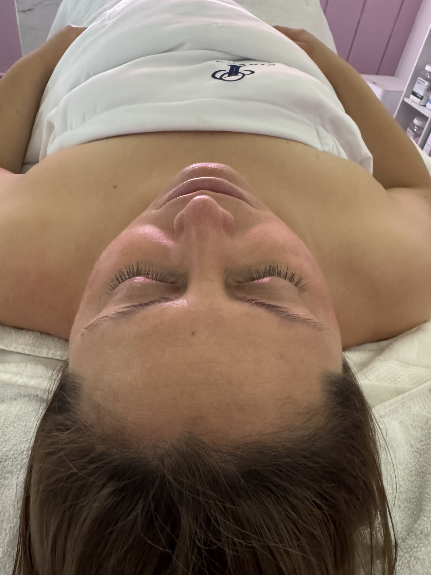 Calm, glowing skin after a custom facial treatment