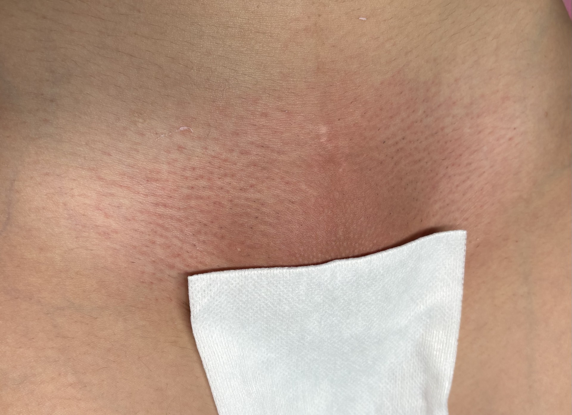 Clean underarm result after a waxing service